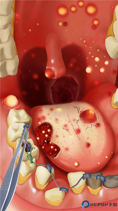 疯狂的诊所游戏