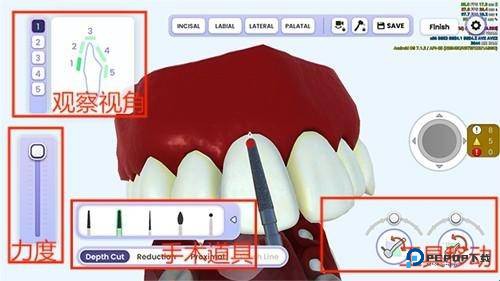 牙医模拟器游戏中文版下载