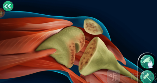 外科手术模拟手机版